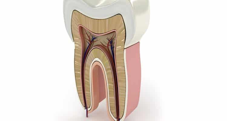 tratamiento-endodoncia-dental-meddicus